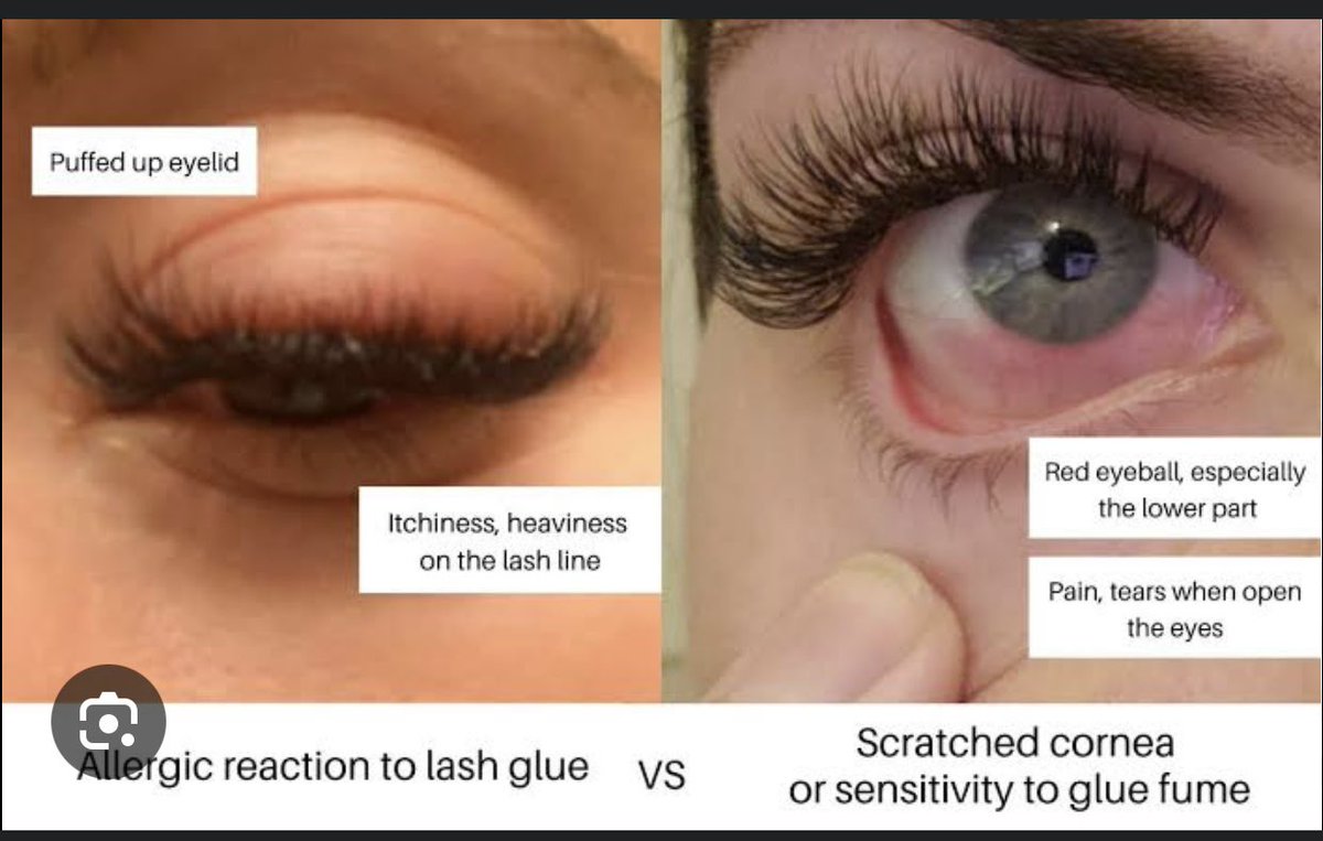 Moh__tun Ⓜ️✨ tweet media