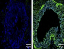 MRC Laboratory of Medical Sciences (LMS) (@mrc_lms) on Twitter photo 💡A living sensor to evaluate the impact of environment on gene expression & health. A new LMS <a href="/LymphDev/">Lymphocyte Development & Epigenetic Memory Groups</a> study in <a href="/CommsBio/">Communications Biology</a> uses the light of a firefly to illuminate cells, revealing how vulnerable our lungs are to external factors.
Read more: lms.mrc.ac.uk/news/ 💡A living sensor to evaluate the impact of environment on gene expression & health. A new LMS <a href="/LymphDev/">Lymphocyte Development & Epigenetic Memory Groups</a> study in <a href="/CommsBio/">Communications Biology</a> uses the light of a firefly to illuminate cells, revealing how vulnerable our lungs are to external factors.
Read more: lms.mrc.ac.uk/news/