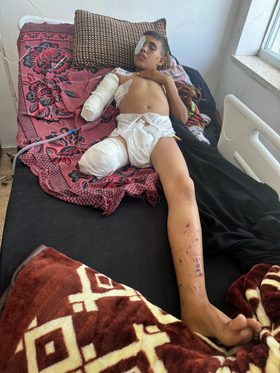 Each day injured kids from #Gaza are submitted to HEAL Palestine for care. None is more depressing than than 12y Waheed, injured by an unexploded ordinance last week. He lost an eye, hand and leg. I started HEAL to take responsibility for these kids. How do we heal this child?