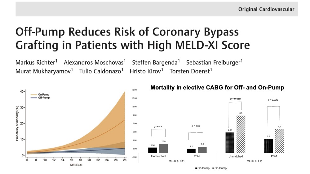 ❗️Check out this new risk-adjusted analysis with 3,535 patients

👉🏻Elective CABG patients with elevated MELD-XI scores are at increased risk for perioperative mortality and morbidity
👉🏻This risk can be significantly mitigated by performing CABG Off-Pump

🔗shorturl.at/X8ryo