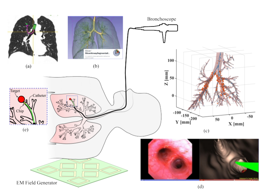cantillonmurphy's tweet photo. Our groundbreaking on-chip magnetic sensor is the culmination of 10 years of research and enables 3D position tracking in image-guided navigation bronchoscopy. https://t.co/yUiy62Zeab
@ERC_Research @UCCResearch @TyndallInstitut https://t.co/tdWDc18p5s