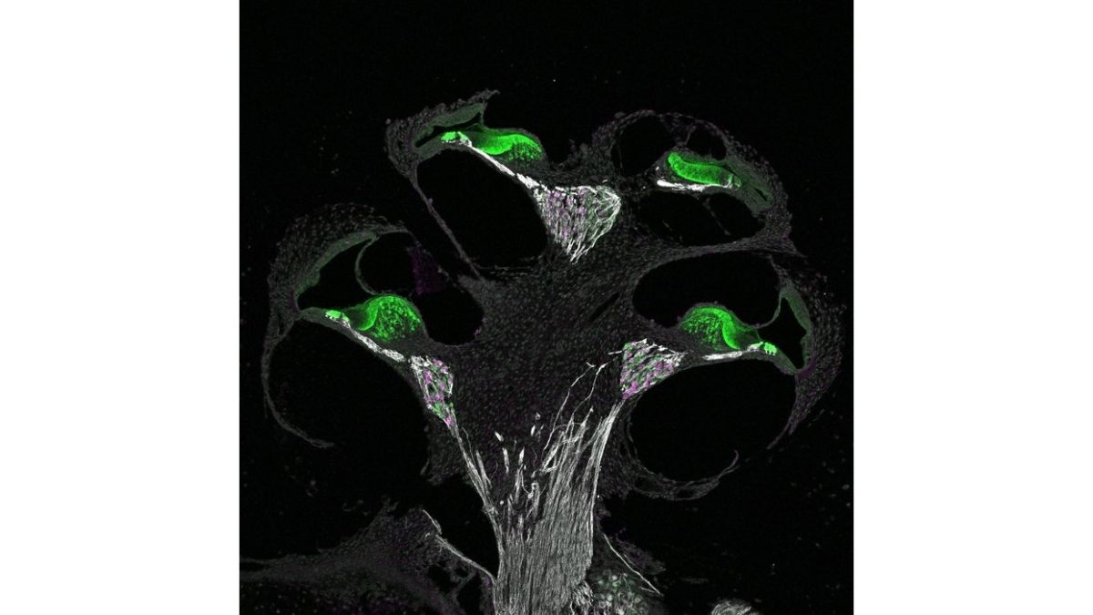 #SciArt for #NSLHM: Neurons in a mouse inner ear that relay sound signals to the brain. Credit: #NIDCDgrantee Dr. Tessa Sanders