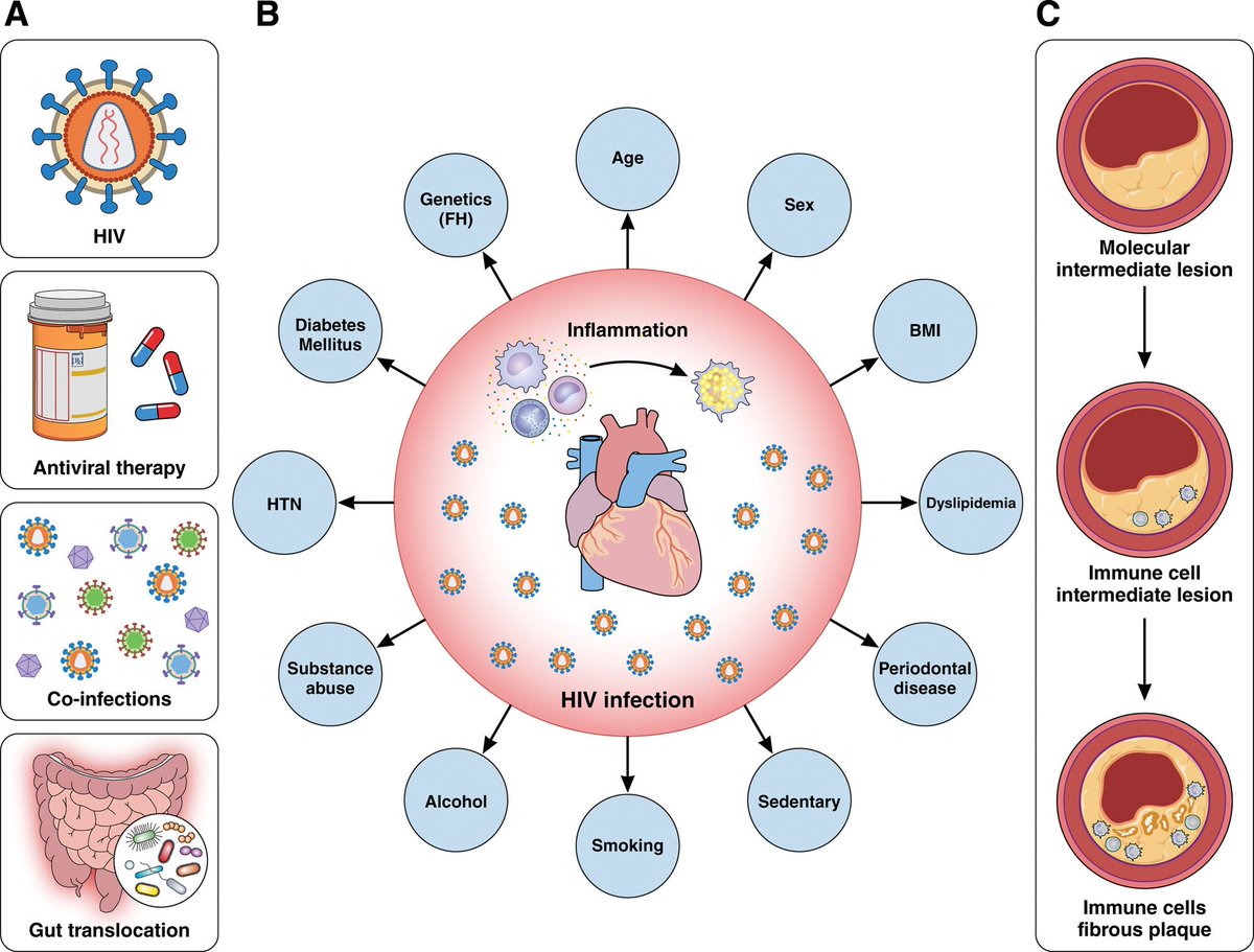 Excited to share our paper @Laventaobare @tecla_temu @VUMC_heart @VUMC_MedPSTP @VI4Research , 'Inflammation in HIV and Its Impact on Atherosclerotic Cardiovascular Disease' now published in @CircRes ahajournals.org/doi/10.1161/CI…