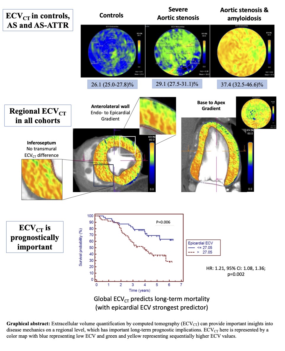 Regional extracellular volume by cardiac CT provides pathological insights into fibrosis+amyloidosis and informs prognosis. #WhyCCT @Barts @UCL <a href="/QMUL/">Queen Mary University of London</a> <a href="/ThomasTreibel/">Thomas Treibel</a> #AHAJournals <a href="/JiwonKimMD/">Jiwon Kim, MD</a> <a href="/kaznegishi/">Kaz Negishi@Cardiologist/ Heart Mafia</a>
ahajrnls.org/3wN9R5O