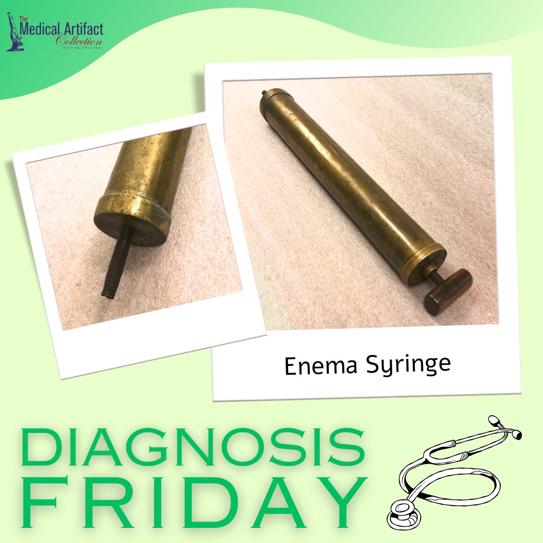 Today's #DiagnosisFriday: an enema syringe. Enemas were popular in the 1800s because of the belief that the bowels needed to be cleaned out regularly. 
Learn more here: bit.ly/3X0ZMNr

#WesternU #MedHist #MedicalHistory #LdnOnt @westernuHistory @westernupubhist