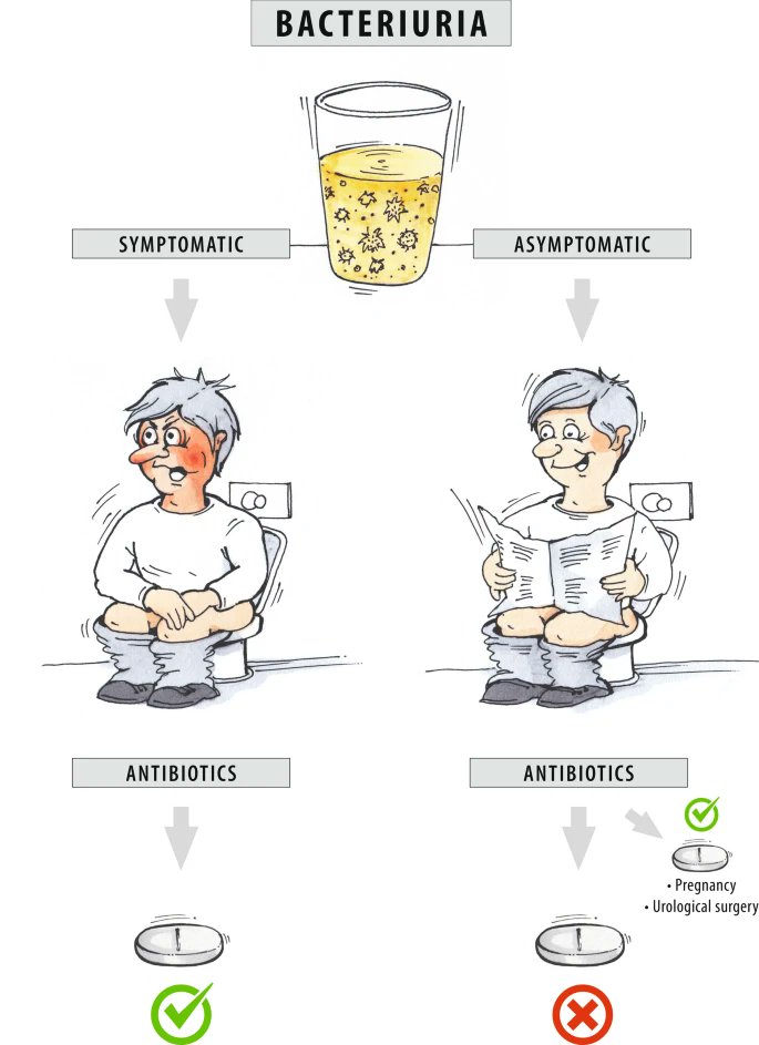 I love it🔥 Asymptomatic bacteriuria Award of the 2023 creative competition In the absence of clinical symptoms of a urinary tract infection, antibiotic therapy is not necessary if bacteriuria is detected (asymptomatic bacteriuria), with a few exceptions link.springer.com/article/10.100…