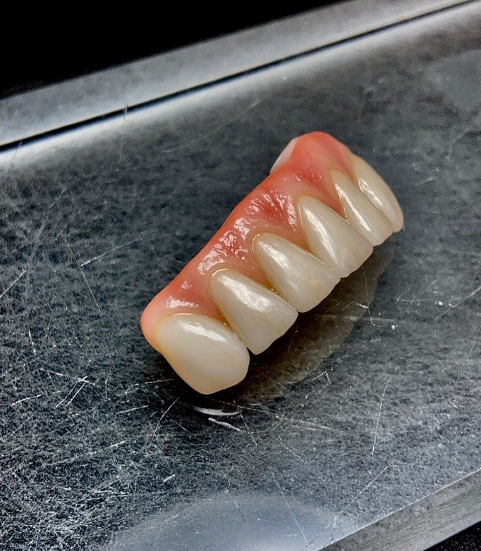 LaboratoryPink's tweet photo. Pink Tissue Porcelain Layering: At Pink Dental, we understand that achieving a natural-looking smile involves attention to the finest details. https://t.co/rwHW5agVsU