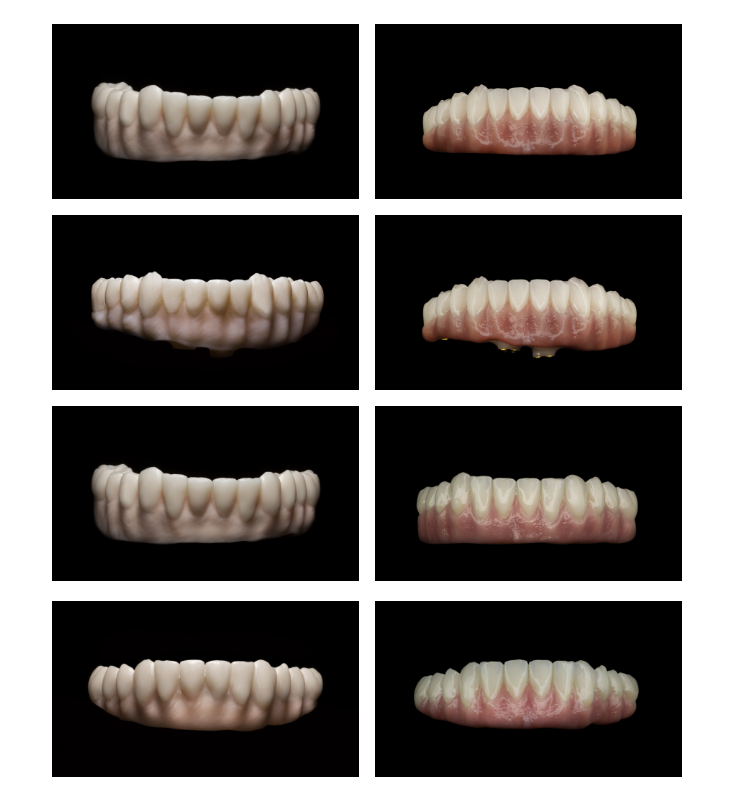 LaboratoryPink's tweet photo. Don't settle for anything less than perfection when it comes to your smile. Experience the difference with Pink Dental's High-End Prosthesis Zirconia Bridge with Pink Tissue Porcelain Layered Completes. https://t.co/djXao5wdAR