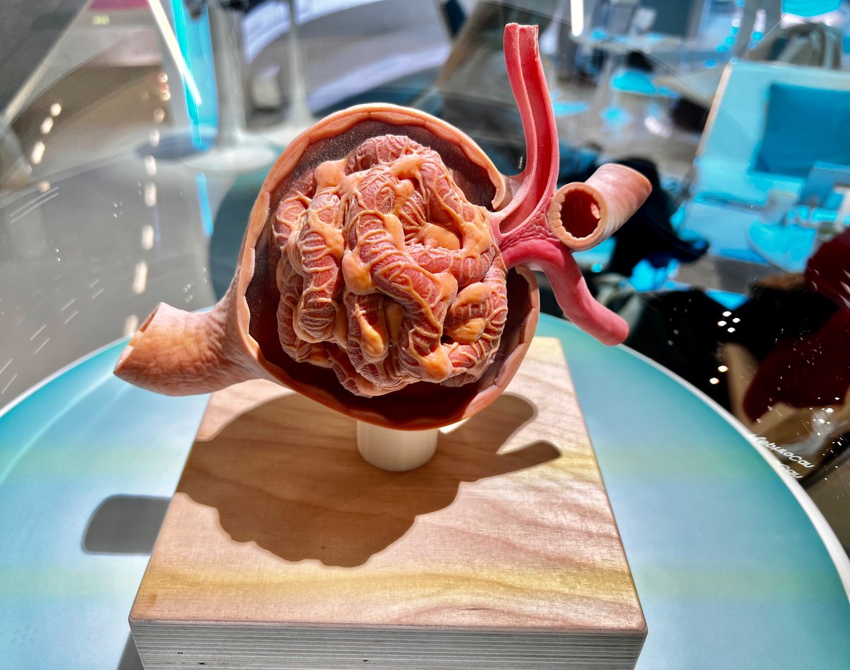 Some love you, some hate you, but no one can ignore you! 🫡
#ERA24 #Nephrocentric