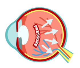 Navigating the maze of self-management in primary glaucoma: insights from a qualitative study