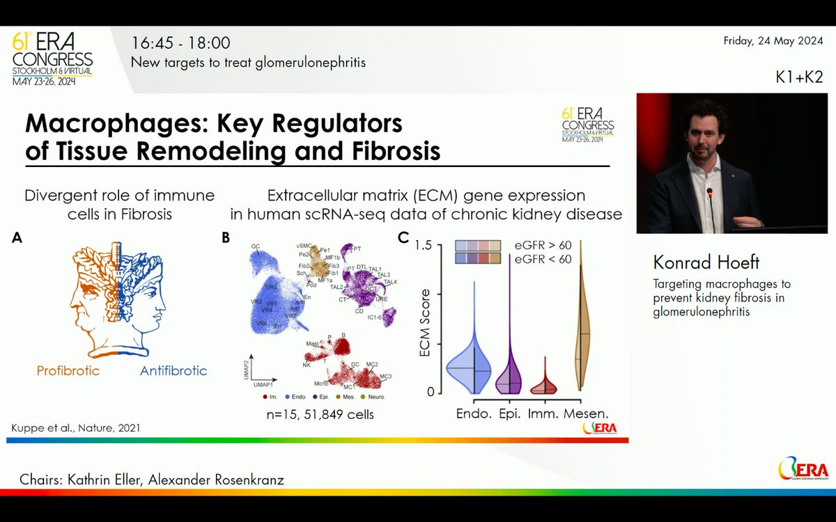 #ERA24  🎯Are there new targets to treat GN?

On behalf of #ERA24 SoMe @merlomar2109 Maribel Merino-López

🚩Targeting macrophages to prevent fibrosis in GN. 
Dr. Konrad Hoeft

👀Very important highlight:
Macrophages are key regulators-remodeling and fibrosis 🧩