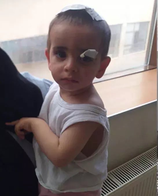 YA DEVLET BAŞA, YA KUZGUN LEŞE..

#KöpekTerörü