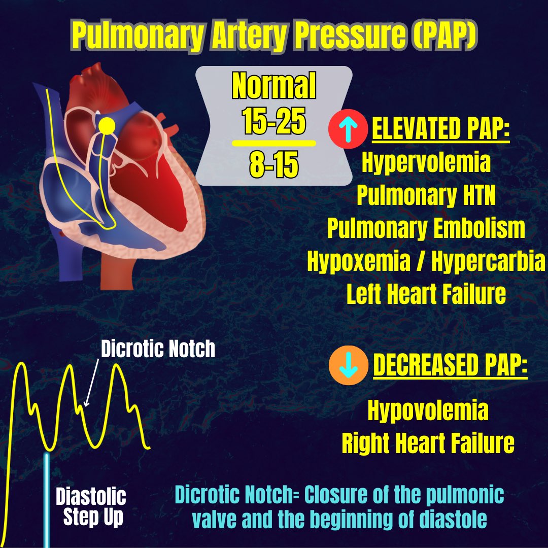 scopeducation's tweet photo. Advanced hemodynamics with @zerohourems on instagram. 
#FOAMed #meded #Cardiology #CriticalCare https://t.co/ABHtQ3LHkF