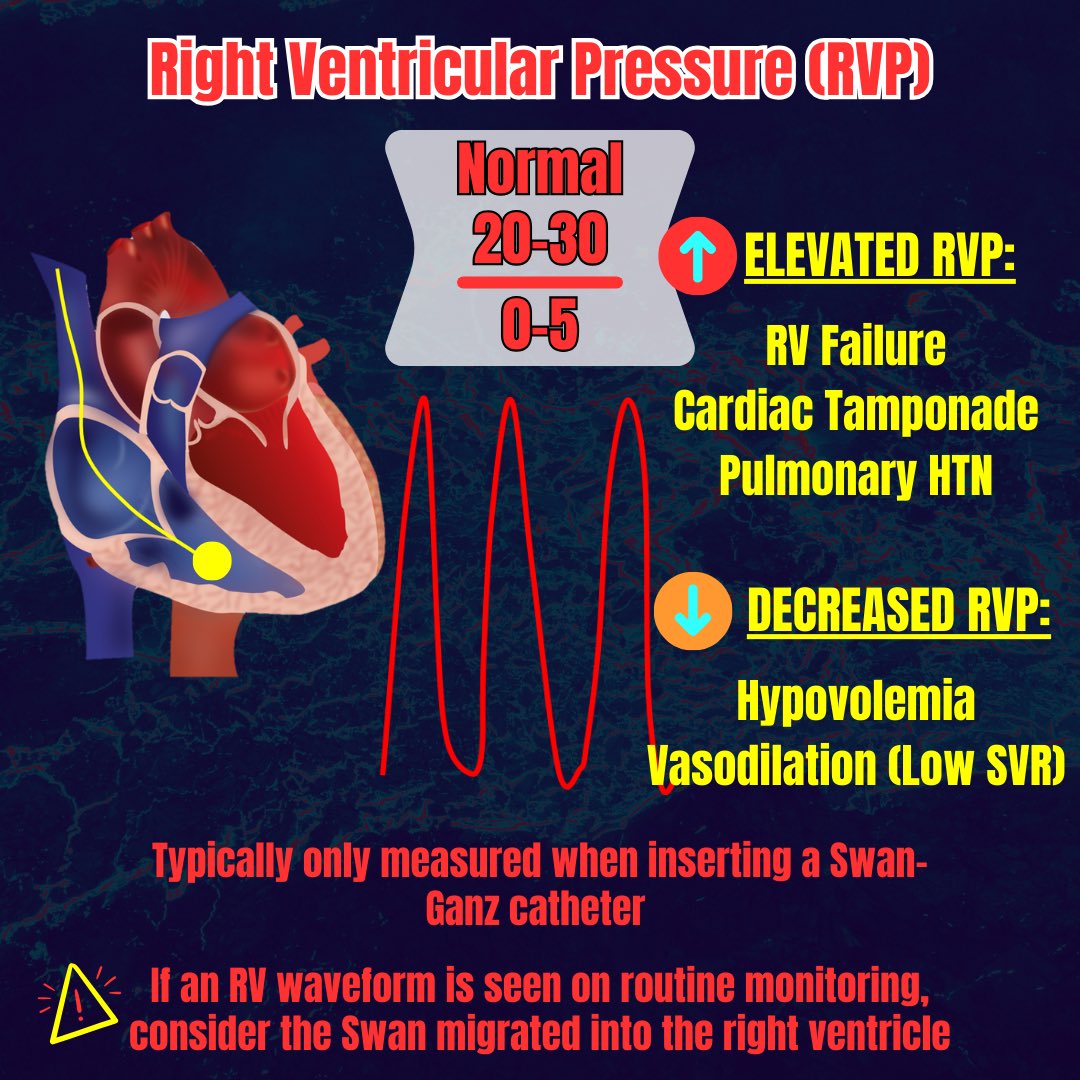 scopeducation's tweet photo. Advanced hemodynamics with @zerohourems on instagram. 
#FOAMed #meded #Cardiology #CriticalCare https://t.co/ABHtQ3LHkF