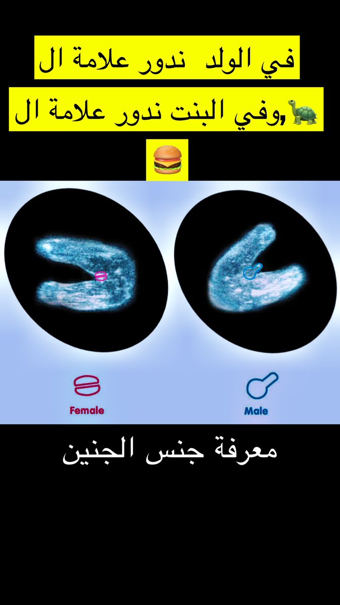 د. خالد الدوسري 🇸🇦🇩🇪 💚 (@kha_aldosari) on Twitter photo 