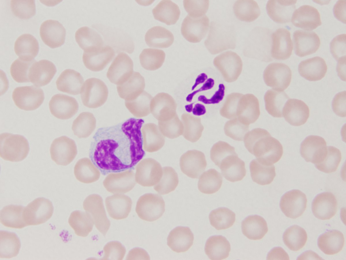 Art of veterinary cytology...

Canine blood
Neutrophil (right) & Monocyte (left)