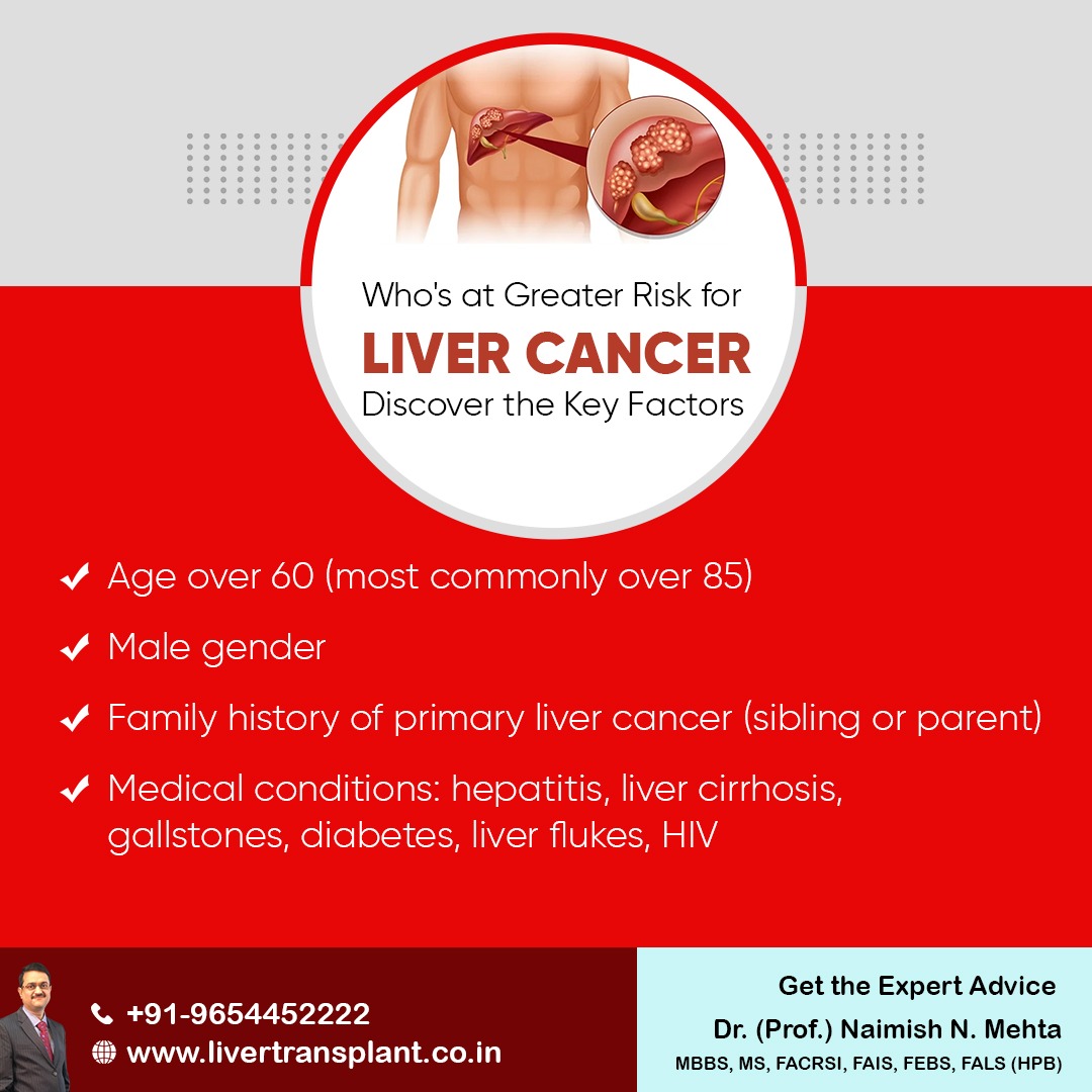 mehta_naimish's tweet image. &quot;Who&apos;s at Greater Risk for Liver Cancer? Discover the Key Factors&quot;
- Age over 60 (most commonly over 85)
- Male gender
- Family history of primary liver cancer (sibling or parent)

#livercancer #LiverProblem #liverpain #DrNaimishMehta