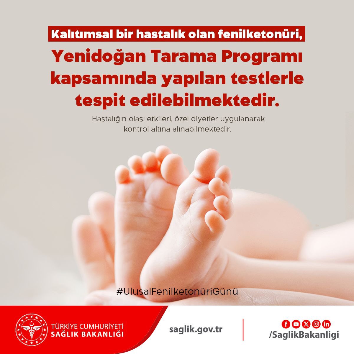 Kalıtımsal bir hastalık olan fenilketonüri, Yenidoğan Tarama Programı kapsamında yapılan testlerle tespit edilebilmektedir. Hastalığın olası etkileri, özel diyetler uygulanarak kontrol altına alınabilmektedir. 
#UlusalFenilketonüriGünü