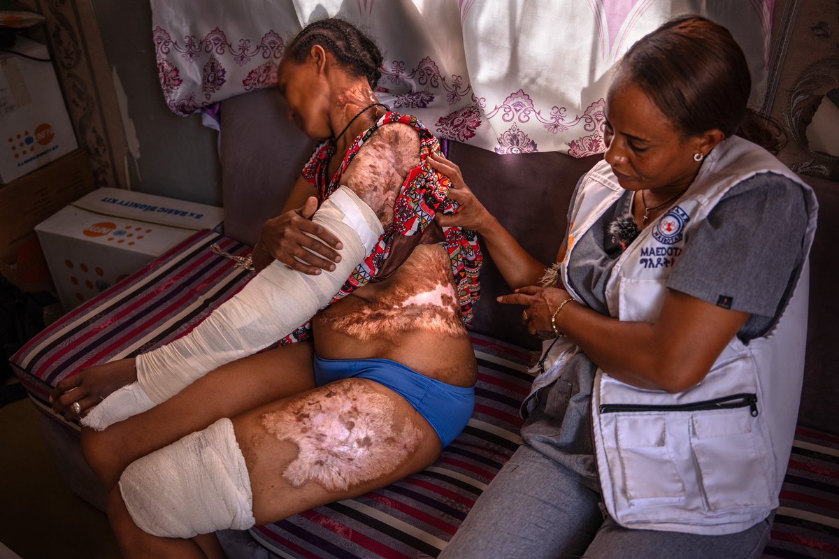 Her name is Azofu, she is 35 years old and was born in the west of Tigray. Before the war she was a farmer with her husband, but because of the war she does not know what happened to him, whether he is alive or not.

<a href="/UN_Women/">UN Women</a> <a href="/unwomenafrica/">UN Women Africa</a> <a href="/amnistiaespana/">Amnistía Internacional España</a> <a href="/amnesty/">Amnesty International</a> <a href="/EmmaWatson/">Emma Watson</a>