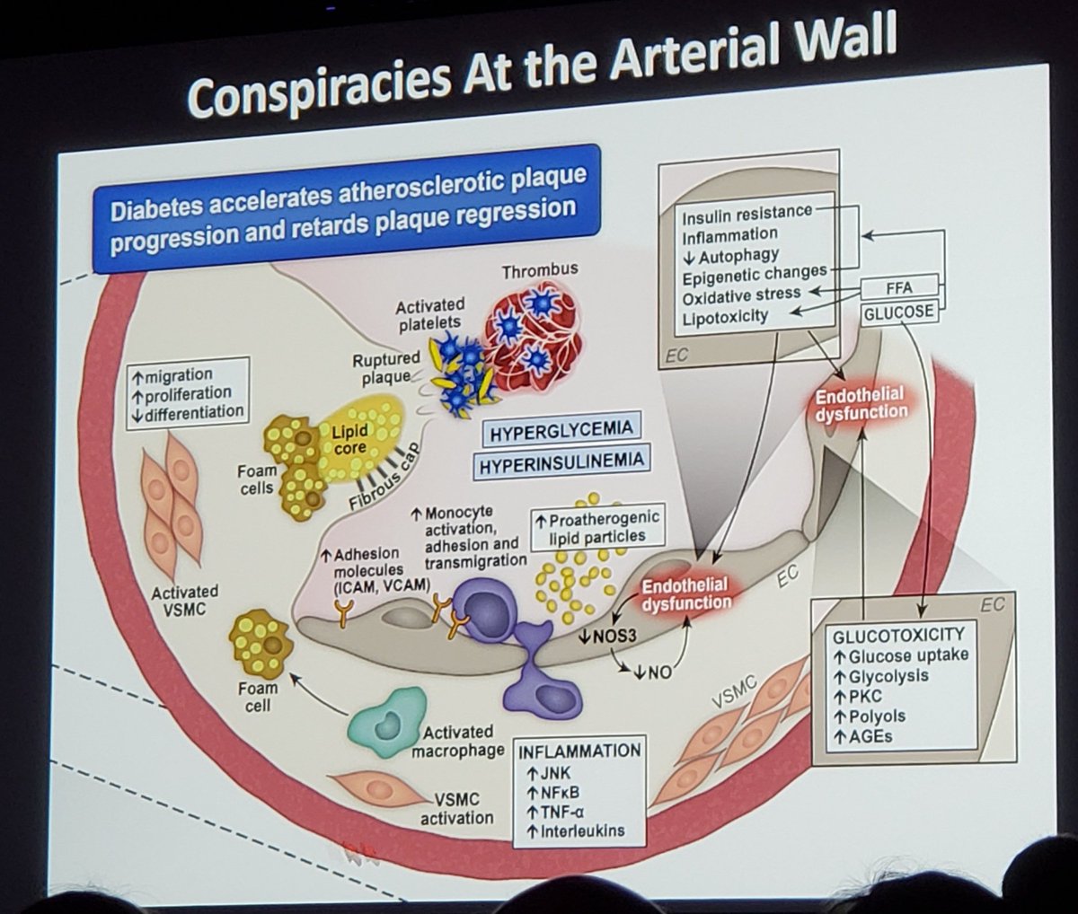 Endocrine News (@endocrine_news) on Twitter photo From #ENDO2024
Diabetes accelerates atherosclerotic plaque progression and retards plaque regression - <a href="/IntMedAbel/">E. Dale Abel</a> From #ENDO2024
Diabetes accelerates atherosclerotic plaque progression and retards plaque regression - <a href="/IntMedAbel/">E. Dale Abel</a>