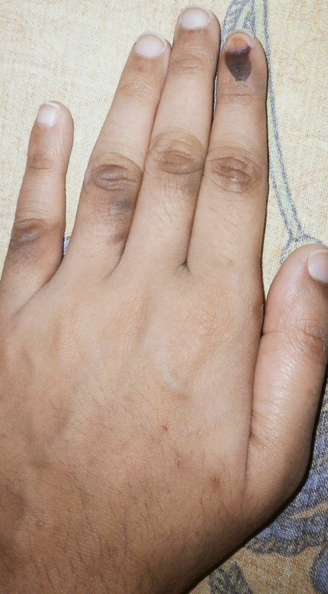 My vote my pride! Happy to be a part of democracy and independence festival of my nation 🙏🙏🙏