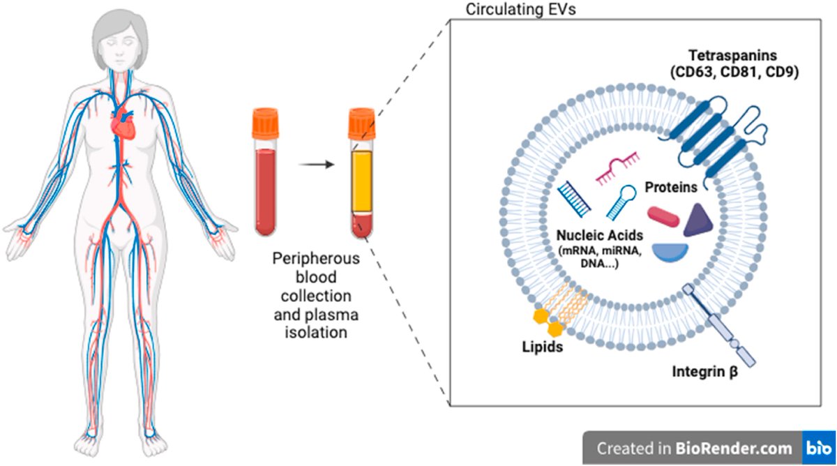 Our abstract on #extracellularvesicles and hypertrophic cardiomyopathy has been accepted at #ESCCongress. A huge achievement for our team. <a href="/AtheroMad/">AtheroMad</a> <a href="/stefanocarugo/">Stefano Carugo</a> pubmed.ncbi.nlm.nih.gov/38192847/