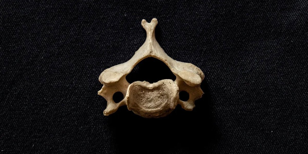 TheSGEM's tweet photo. Pediatric clinical decision tools for c-spine injuries. 
https://t.co/eCiDKKArPE #EBM #foamed https://t.co/Ha7kREiqXX