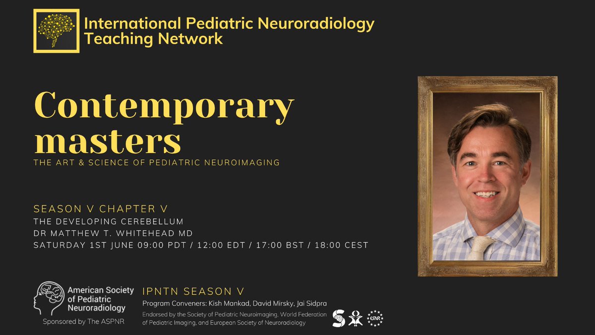 Can you hear the music playing... 1 hour to go! International Pediatric Neuroradiology Teaching Network Season V: Contemporary Masters Chapter V: Matthew Whitehead, MD June 1, 2024 Register here: aspnr.org/learning/inter…… @WorldFederation @spinacademics @ESNRad