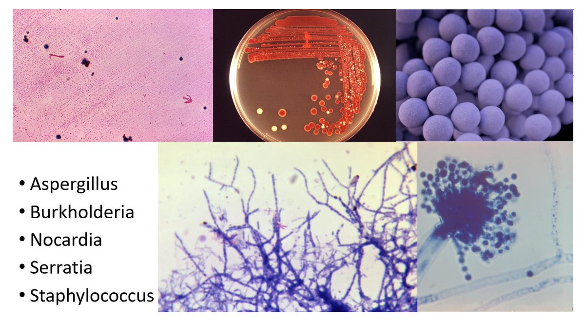 MayoClinicINFD's tweet photo. Weekend Digest

Name the Disease

Five Clues
1. Aspergillus
2. Burkholderia
3. Nocardia
4. Serratia
5. Staphylococcus https://t.co/LjF7nl93xG