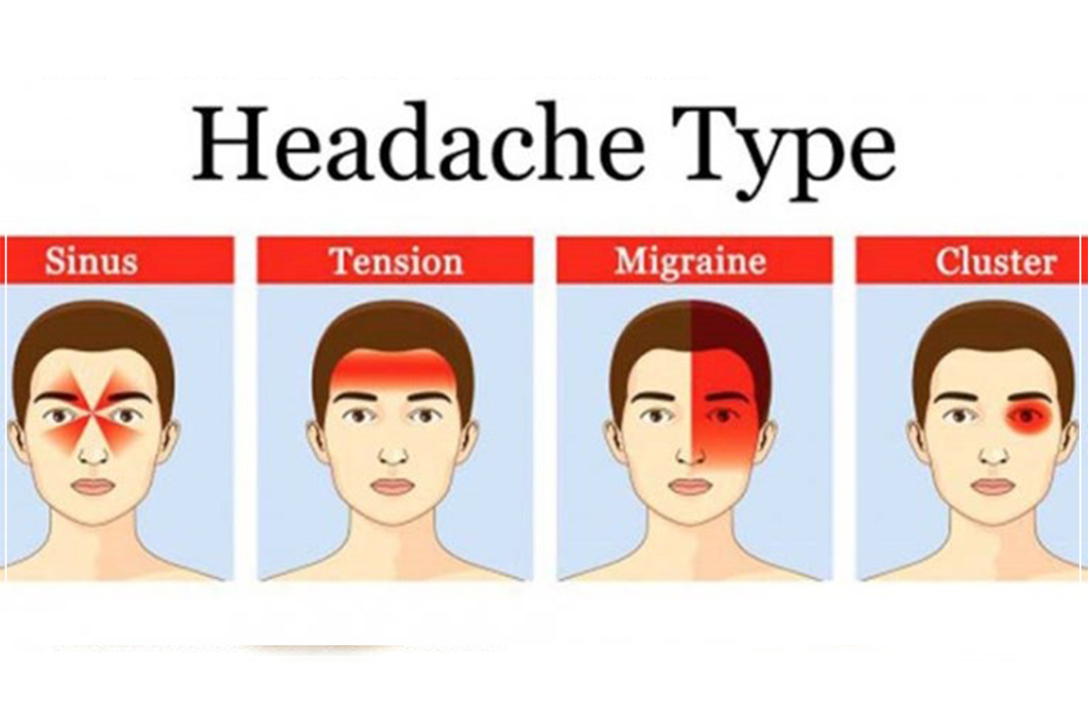 “Doktor, sakit kepala rasa macam nak pecah!”

“Dah berapa hari ni?”

“Dah 2 hari. Rasa sakit sebelah kiri saja. Apa pun tak boleh buat. Rasa loya nak muntah”

Migraine adalah sakit kepala yang menyerang secara berulang, biasanya berlaku di sebelah bahagian kepala sahaja.