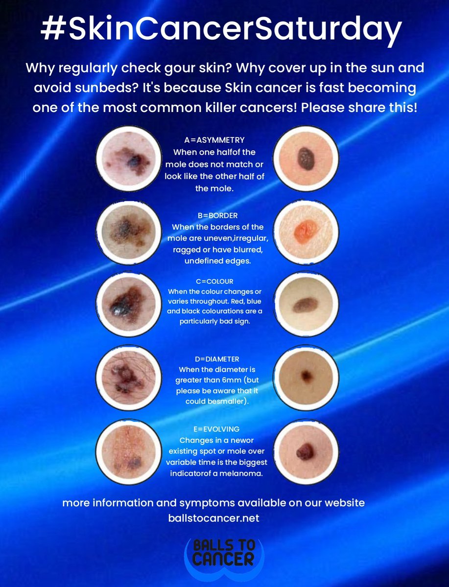 It's a #SkinCancer Saturday. Some don't understand why we ask you to check your skin, use sun block &amp; avoid sunbeds. We do it because skin cancer is rising up that list of cancers as most common killers ballstocancer.net/skin-cancer please share #ballstocancer #CancerSupportCharity