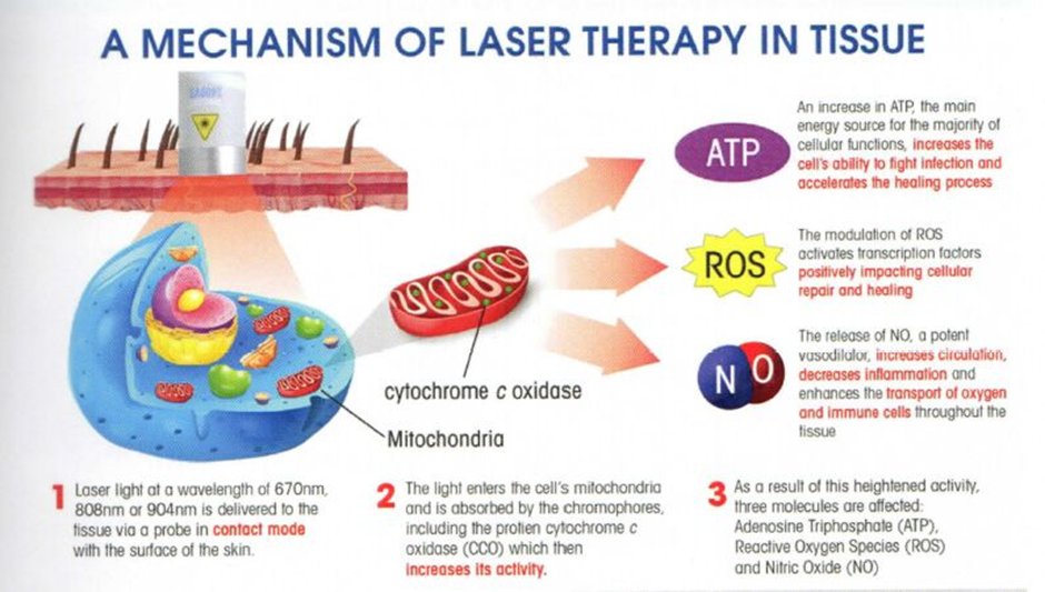 Photobiomodulation (light therapy) has shown promise to help fight multiple effects of chronic stress on the gut-brain axis:

- Using a non-invasive approach targeting the light therapy on both the brain and gut in mice, researchers were able restore the SIRT1 pathway in certain