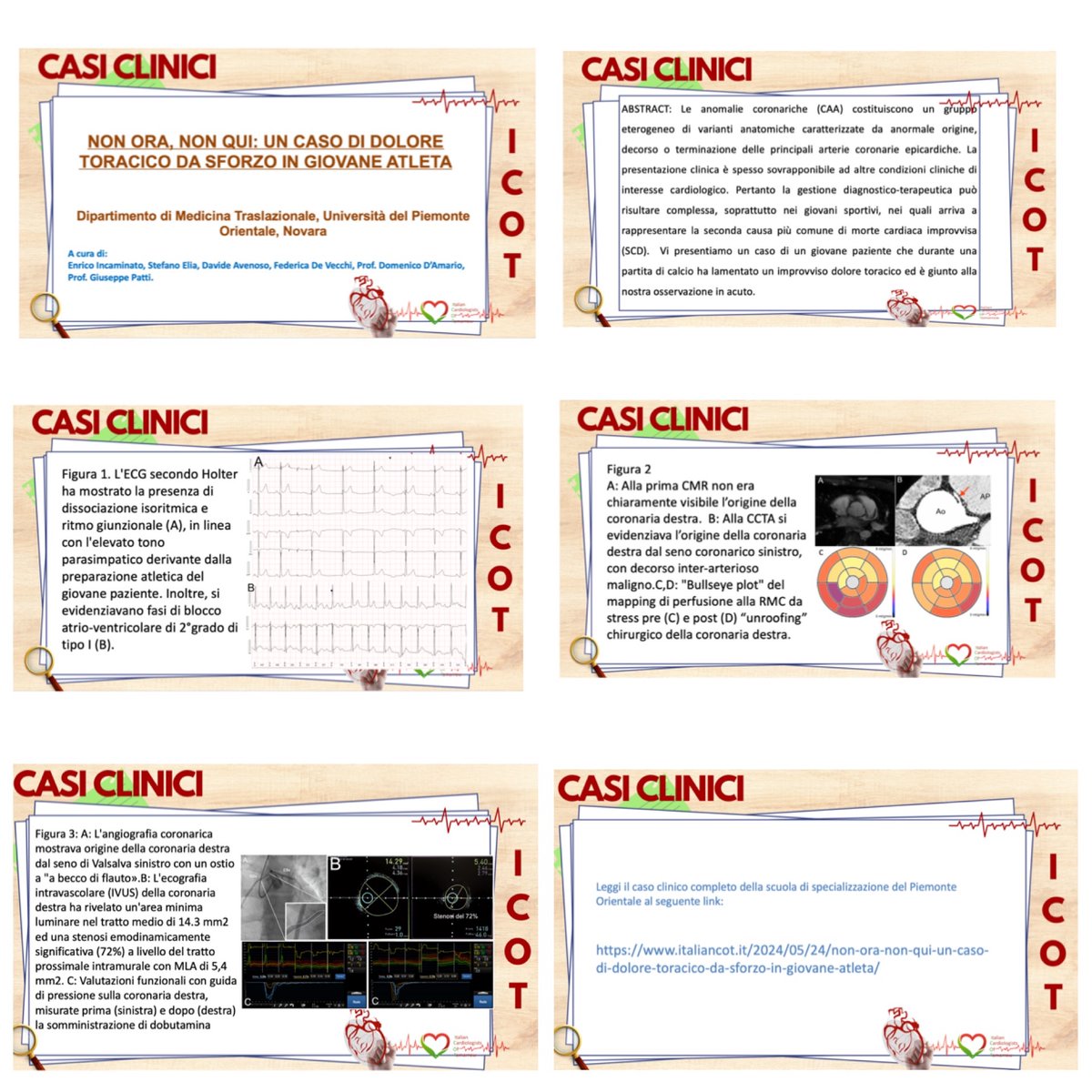 💡🫀ICOT Clinical case of the week 🫀💡cura della Scuola di Specializzazione del Piemonte Orientale

🫀Non ora, non qui: un caso di dolore toracico da sforzo in giovane atleta🫀

❗️Leggi il caso clinico urly.it/3a4mx
#cardiology #cardiologyfellow #coronary #ITcardiology