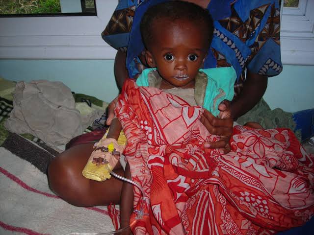 blair_kizza's tweet photo. Day 4 “Nalubiri” Sickle Cells
it's important to understand sickle cell disease, a genetic blood disorder, not a result of witchcraft, as many believe.
This disease is very common in Busoga region and Northern Uganda
Thread 🧵 https://t.co/chE5y8jZGX
