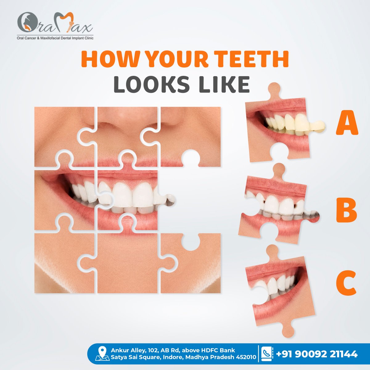 Quiz time! Describe your teeth in the comments below. If you spot any cavities, let us know by commenting 'Cavity'. Let's keep those smiles sparkling! 😄

 #DentalQuiz #HealthyTeeth #SaturdayVibe