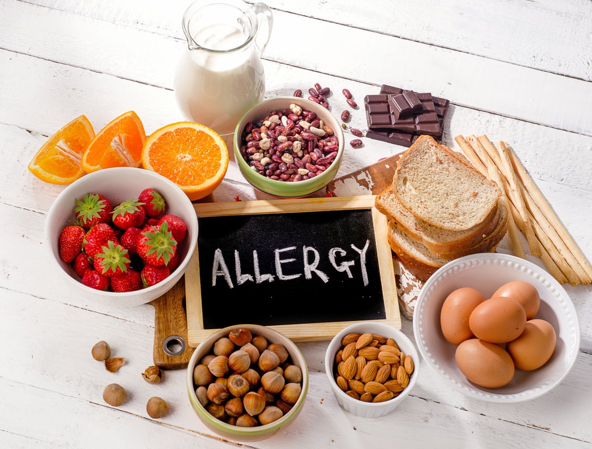 The burden of food allergy on mental health in children can be alleviated with nutritional interventions. #FoodAllergy #ChildHealth  buff.ly/4azzGnx