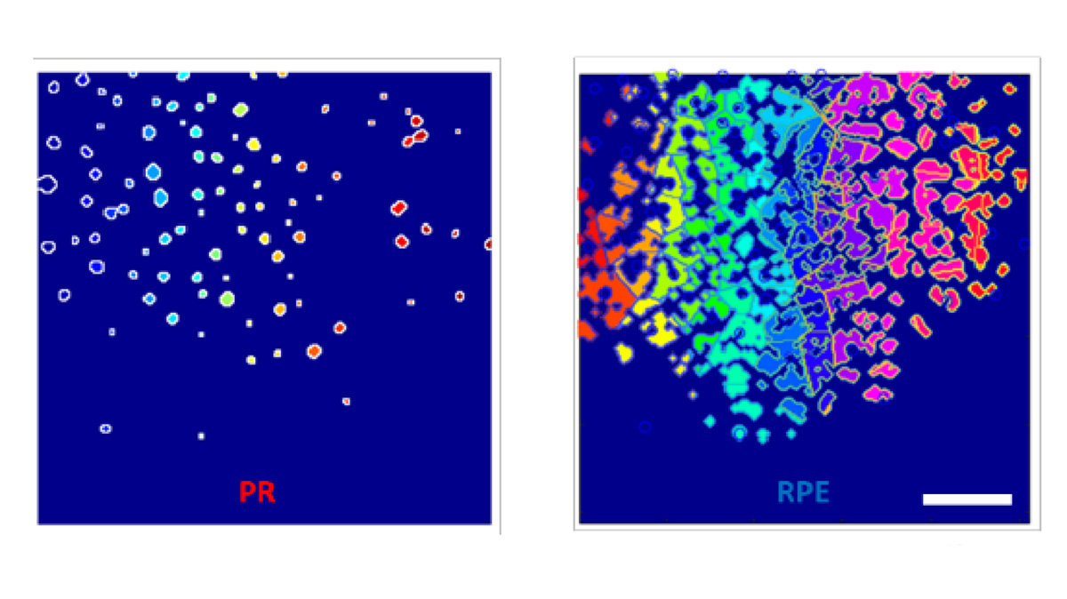 An Editors' Pick via #OPG_BOEx: Two-photon autofluorescence lifetime assay of rabbit photoreceptors and retinal pigment epithelium during light-dark visual cycles in rabbit retina ow.ly/JoZ950RPsCj #Microscopy #FluorescenceImaging @UTBiomedical