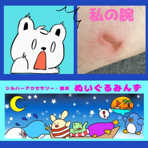 NUIGURUMINZ's tweet photo. #ハンドメイドあるあるハプニング　はケガと品違い
先週溶かした金属に当たってしまいヤケドした（≧∇≦）皆さんもケガには気をつけてね
あとは注文したパーツの品違い、発注時に私がミスしてたり、お相手が間違えていたり
なるべく早く開封して検品をしてます
#365DIYtheme
#ぬいぐるみんず https://t.co/bw3gyRW5s0