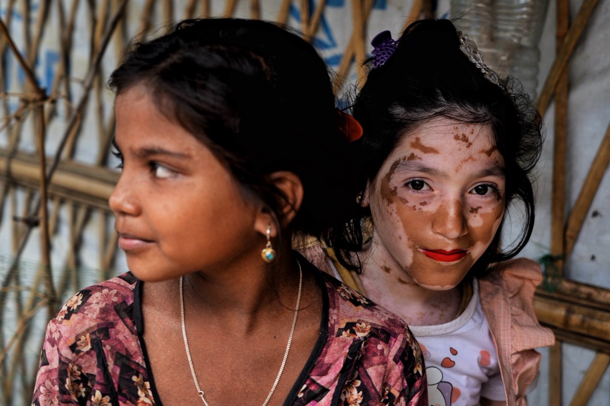 Due bambine nel campo rifugiati del popolo Rohingya.