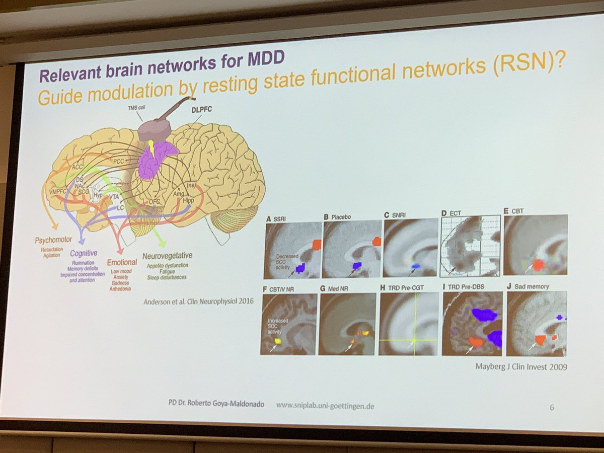 In clinical depression, the default mode network interoceptive), salience and attention networks are all implicated. Dr Roberto Goya-Maldonado uses rTMS to treat treatment resistant depression and optimizing the stimulus parameters is a key topic of research - the left DLPFC