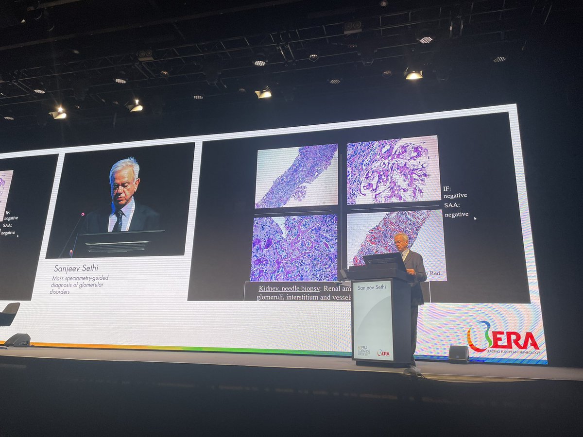 Happening now! Dr @SethiRenalPath presenting on Mass spectrometry-guided diagnosis of GN disorders #ERA24 @ERAkidney @MayoClinicNeph @MayoClinicPath