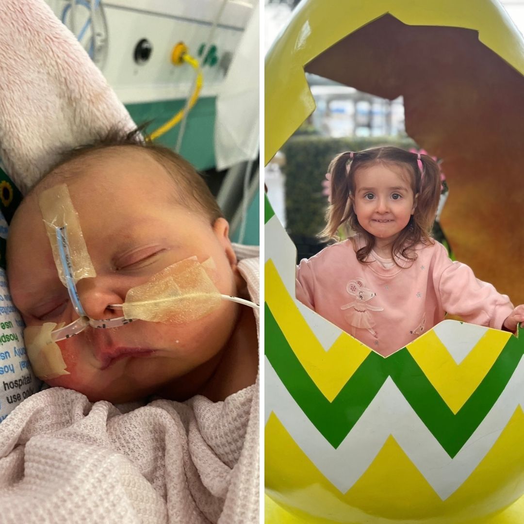 Little Poppy the day she was born, to now, two and a half years old!😍 Emily, Poppy’s mum told us, “Poppy was born with a cleft palate due to a condition called Pierre Robbins Sequence. Only 50 babies a year are born with this condition, so to us, she is extra special!”