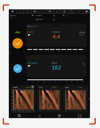 Next-Generation FibroScan With Improved Measurement Guidance Released Worldwide Learn more ➡️ bit.ly/3VdmlNl @Echosens #RadNews #Imaging #Radiology #Ultrasound