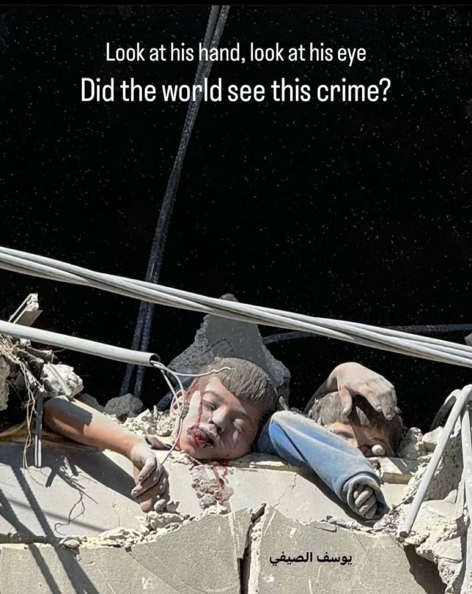 Bu fotoğrafı asla unutmayacağım, siz de unutmayın..

Bu acıya alışmayın..