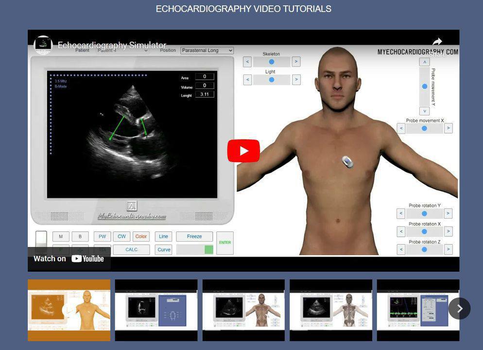 Free Echocardiography video tutorials: myechocardiography.com/VideoGallery.h…