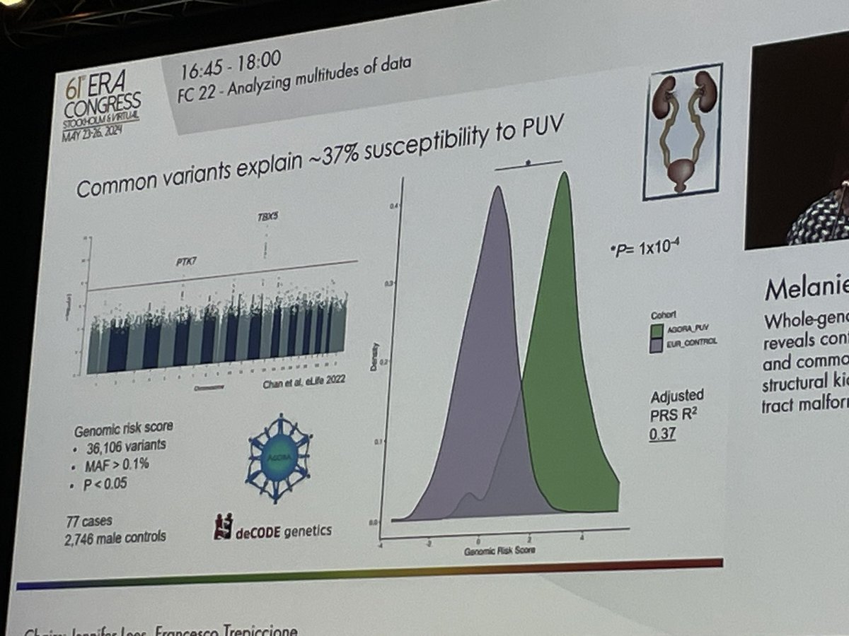 Lucile Figueres (@lucilefigueres) on Twitter photo The complexe genetic of CAKUT by <a href="/drmelaniechan/">Melanie Chan</a> #ERA24.
Using the 100 000 🧬 project : 4% of diagnosis, mostly HNF1b
Looking for rare variant compared to control : negative
Some answer in polygenic score such as in PUV
CAKUT remain a mysterious genetic story ! The complexe genetic of CAKUT by <a href="/drmelaniechan/">Melanie Chan</a> #ERA24.
Using the 100 000 🧬 project : 4% of diagnosis, mostly HNF1b
Looking for rare variant compared to control : negative
Some answer in polygenic score such as in PUV
CAKUT remain a mysterious genetic story !
