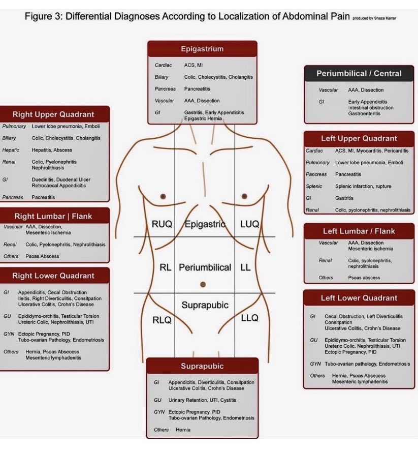 Differential Diagnosis of Abdominal pain 

#meded #medx #abdominalpain
