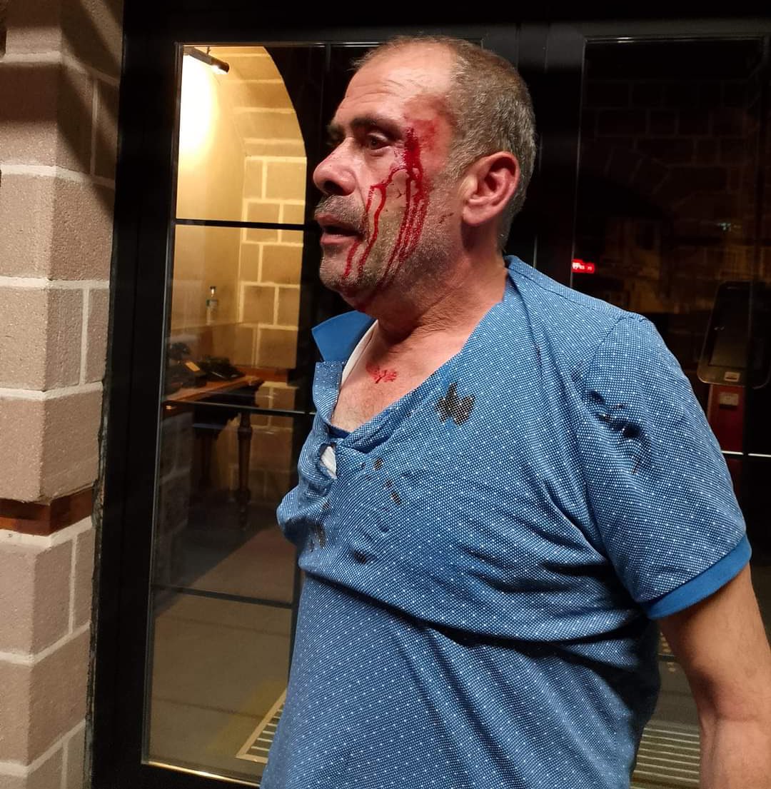 Altındağ Belediyesi’ne Yönelik Şok İddia! 

Altındağ Belediyesi’nde işine son verilen belediye şirket işçilerinden birinin; işten çıkarılmasına tepki gösterdiği için akşam belediyenin güvenlik görevlileri tarafından evi basılarak darp edildiği iddia edildi. 

İsminin Seyit Ali