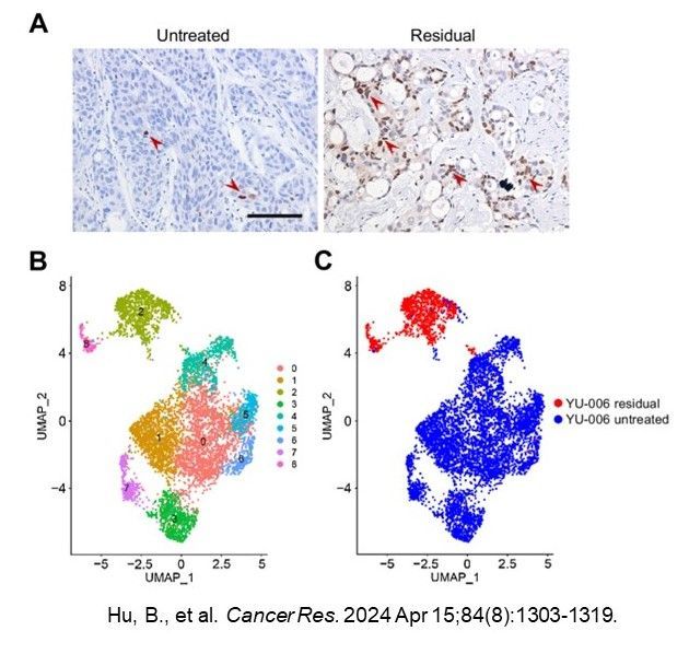 Using patient-derived xenografts in a study funded by @theNCI Patient Derived Models of Cancer Program, @politikaterina @YaleCancer et al. revealed mechanisms by which ASCL1 drives tolerance to osimertinib in #EGFR mutant #LungCancer @CR_AACR aacrjournals.org/cancerres/arti…. #LCSM