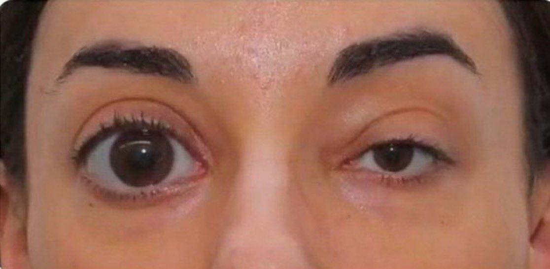 *Me trying to look good in pictures*

my eyes: